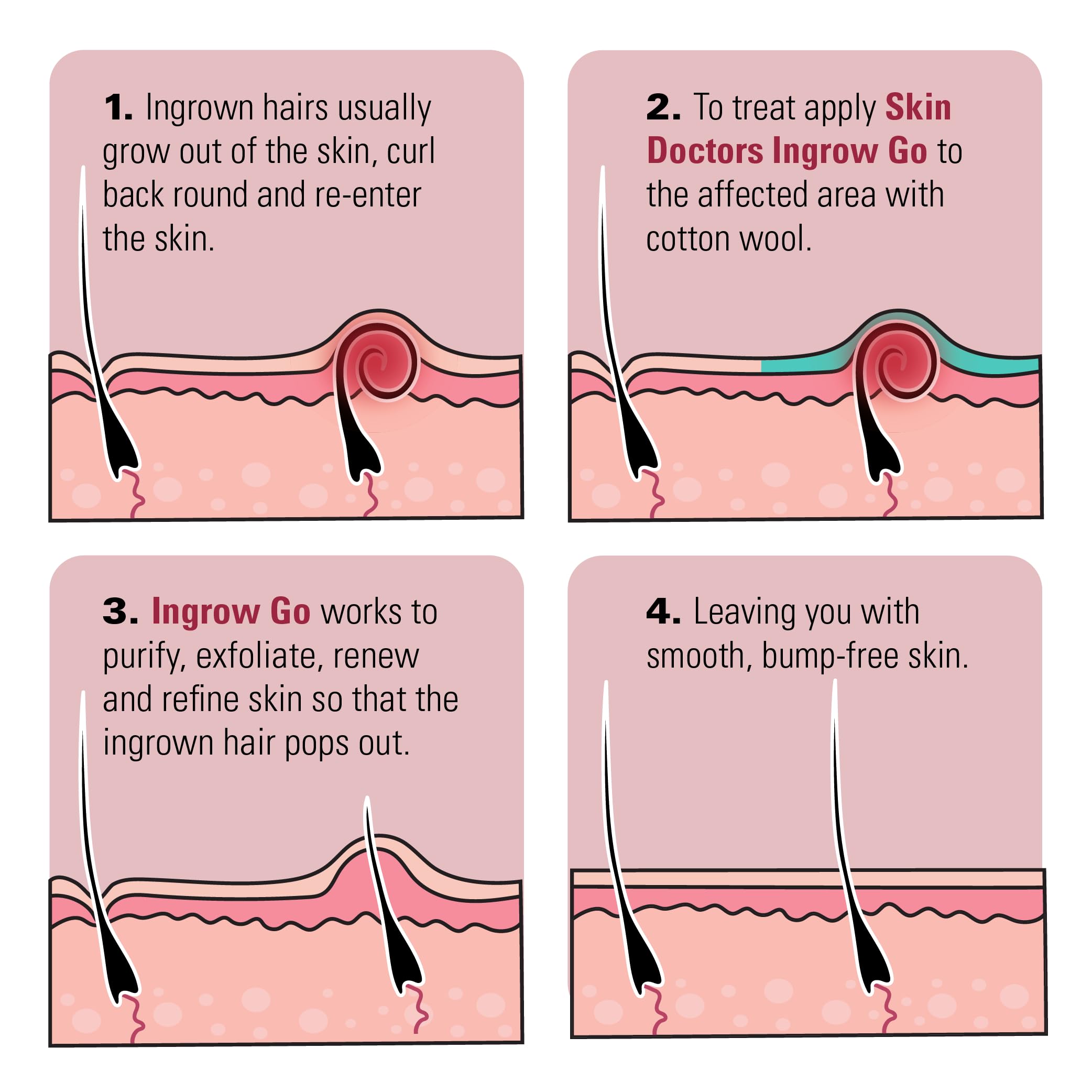 Skin Doctors Ingrow Go Ingrown Hair Lotion 120mls